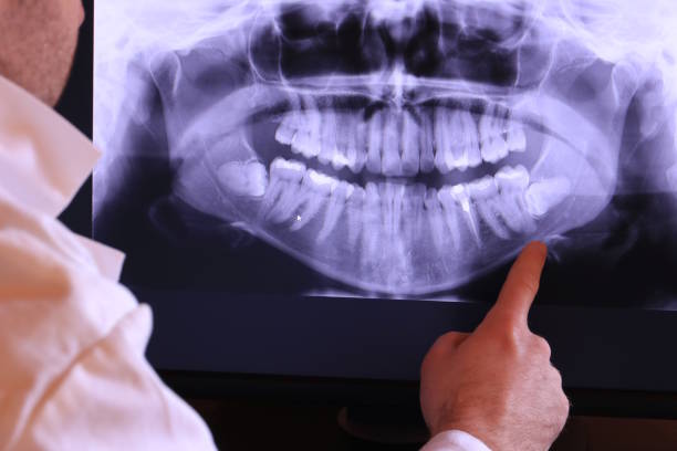 Best Emergency Dentist for Knocked-Out Tooth in Purvis, MS